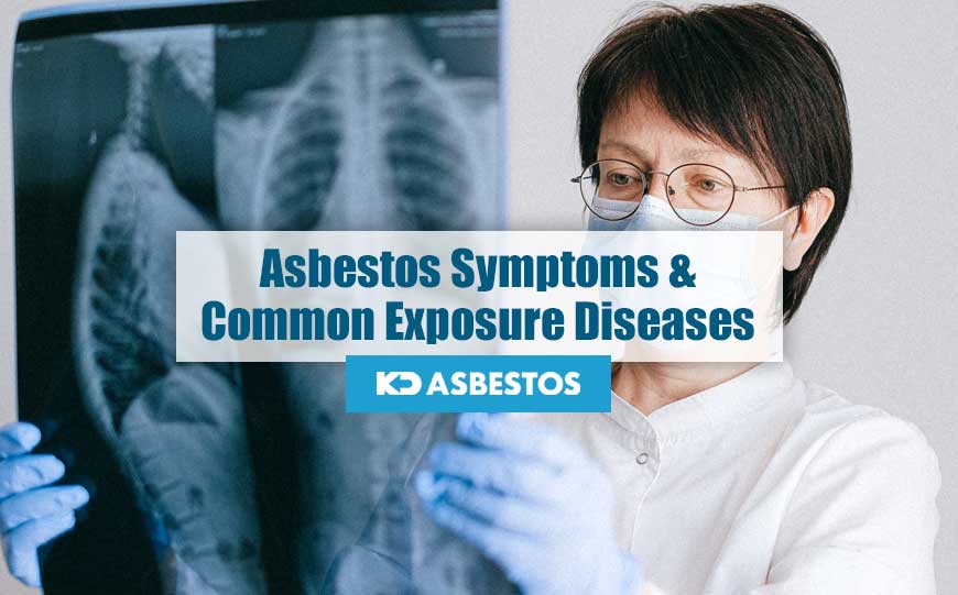 Symptoms asbestos Asbestos exposure symptoms